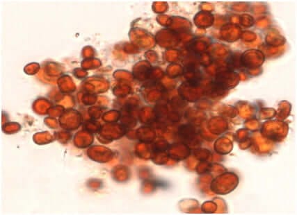 red-rain-cells