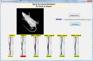 Spine Curvature Estimation