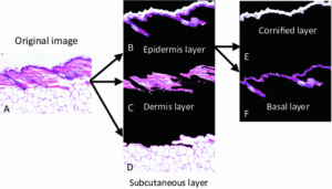 A diagram showing epidermis curvature 
