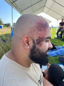 Actor with special effect wound on side of the head