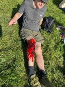 Special effect leg injury